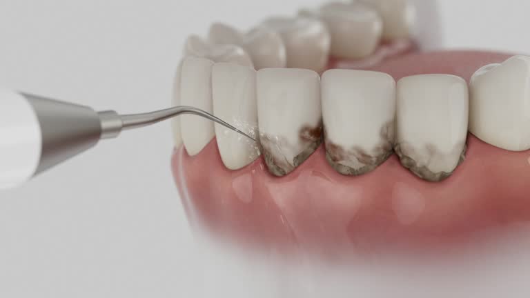 Reliable Tooth Extraction contractor in Brooklyn, OH by Smile Center Dentistry